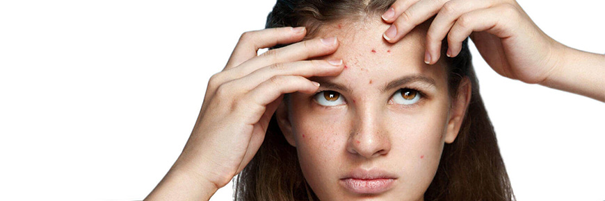 Acné, marcas, rojeces, irritación… Los problemas de la piel de los jóvenes tienen solución, y a buen precio. 
